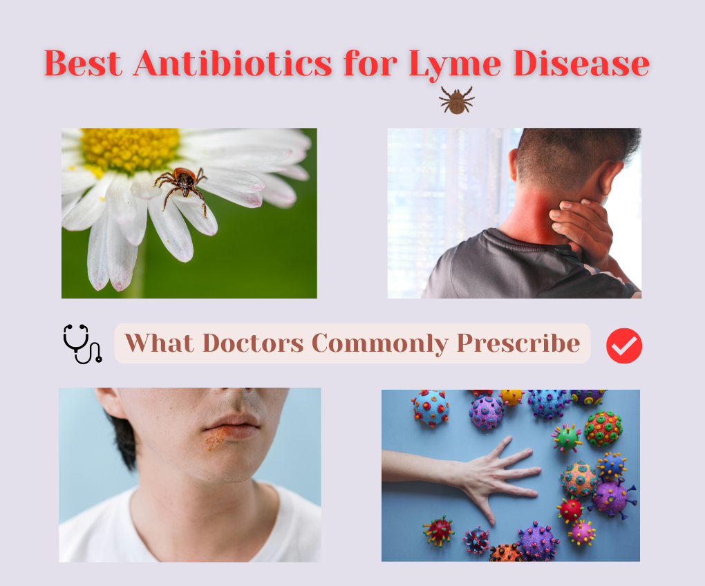 Best Antibiotics for Lyme Disease What Doctors Commonly Prescribe